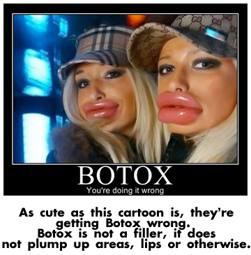 botoxwrong A funny picture about the effects of Botox when used incorrectly.