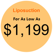 Liposuction Starting Price Icon The starting price for our liposuction procedures.