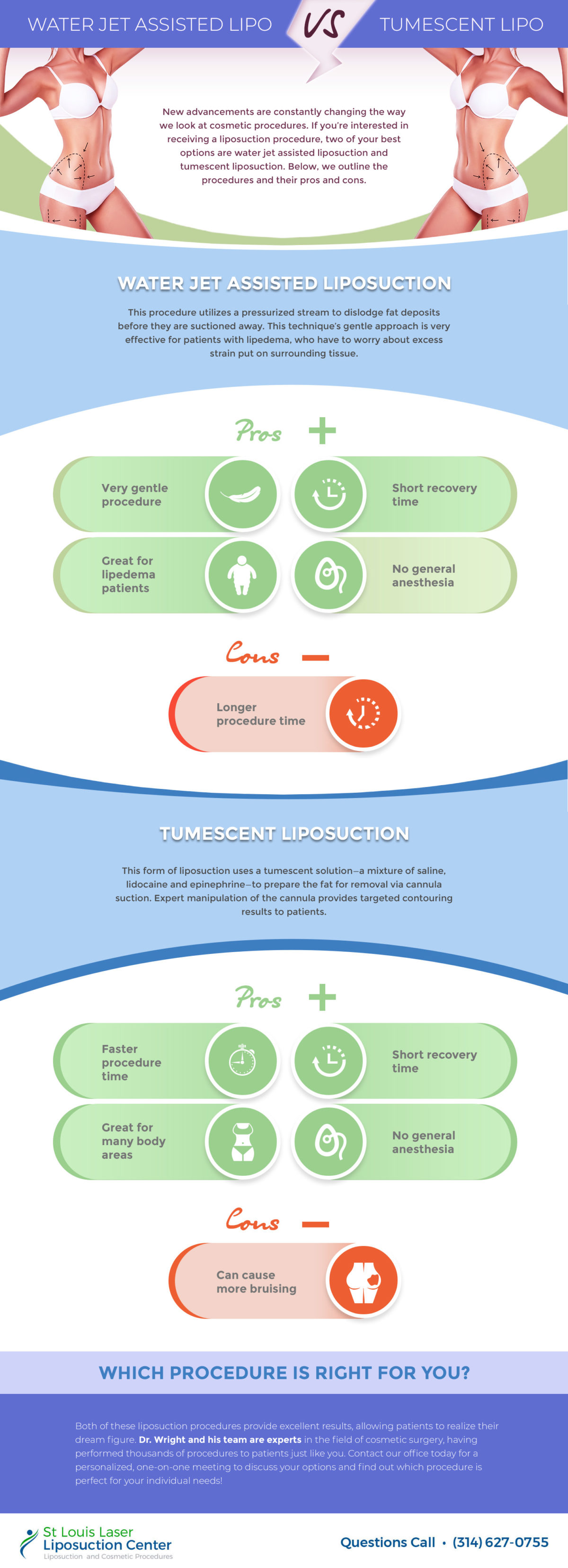 Learn About The Water Assisted Liposuction | St Louis Lipo