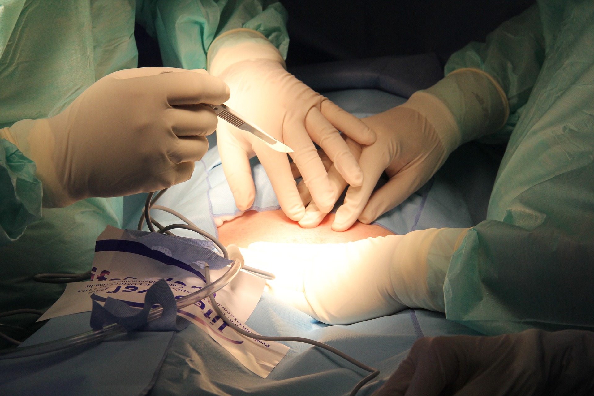 Procedures to Avoid