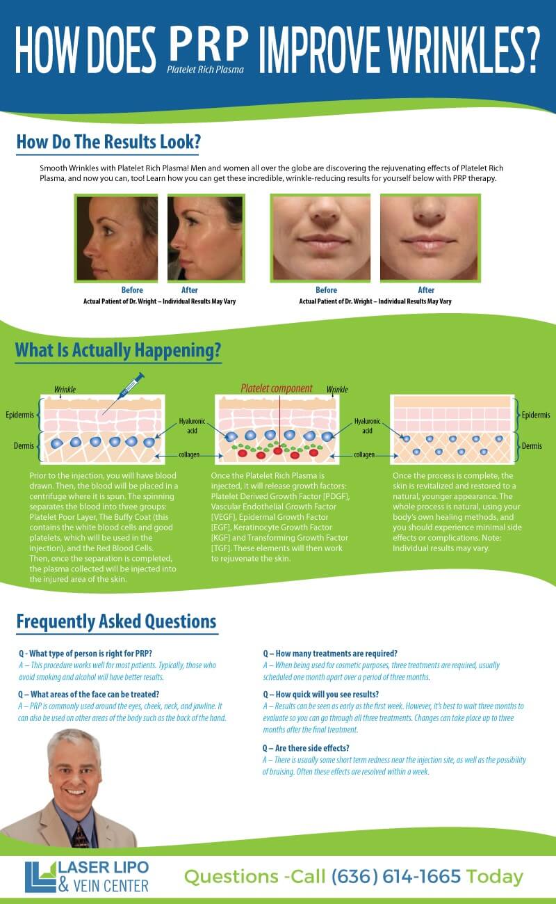 All About PRP Injection Therapy St Louis Liposuction