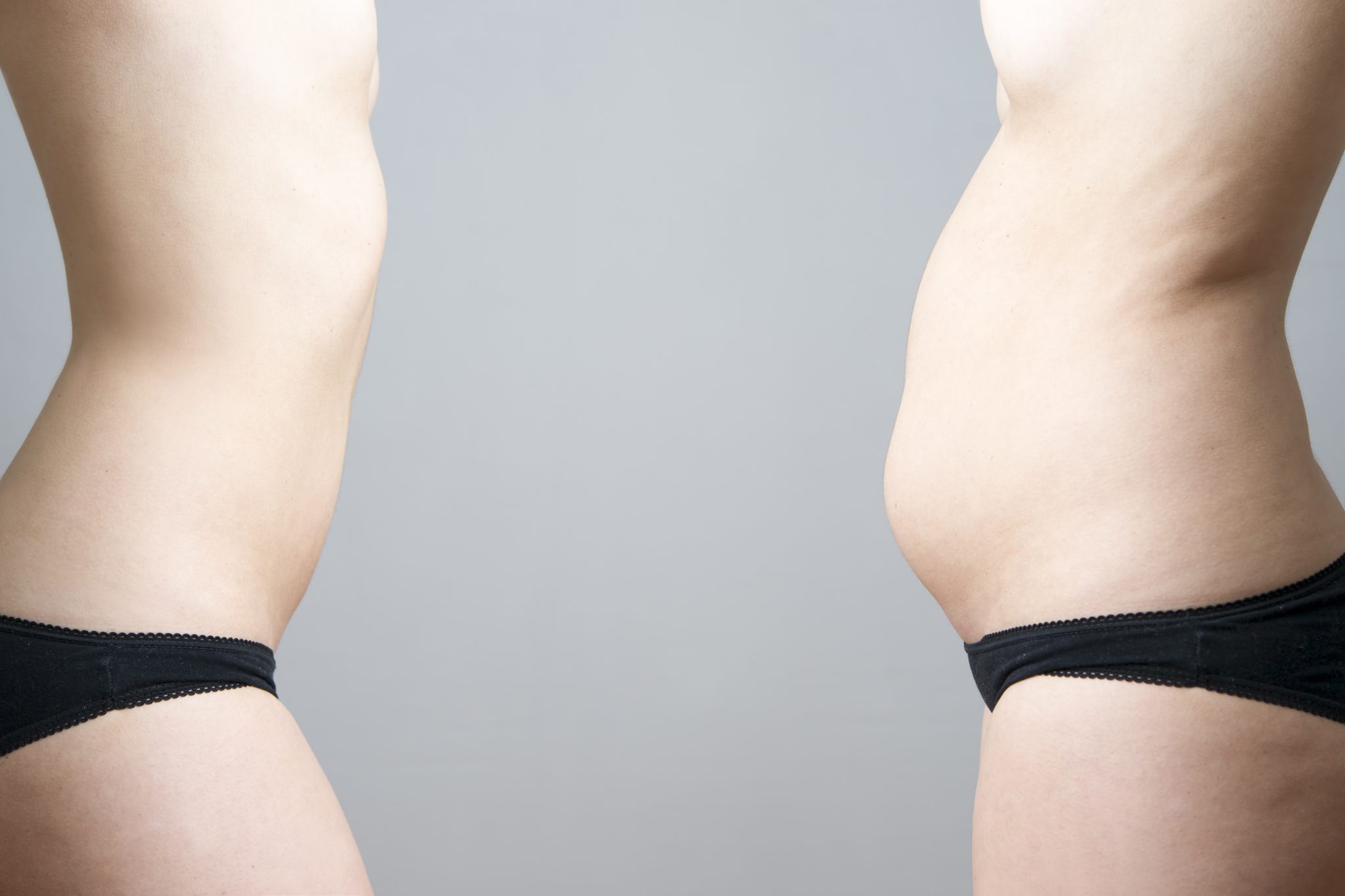 Живот примтоме. Растет живот у женщин после 60. Гормональный живот фото. Задержка жидкости в животе у женщин. Женщина с дряблым животиком.