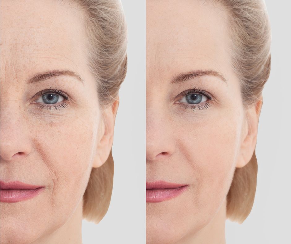 The Ever-Evolving World of Cosmetic Procedures and Skin Care - St Louis Lipo